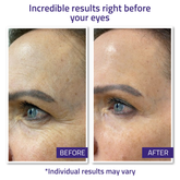 Instant Face Lift Cream 15ml